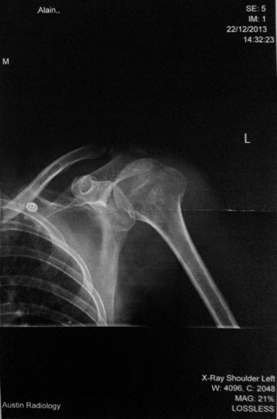 There is a fracture in here somewhere. That sentence is a good sign.